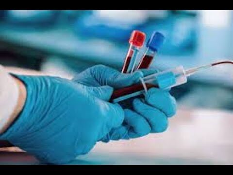 Explorando la Anatomía de los Tubos de Dirección